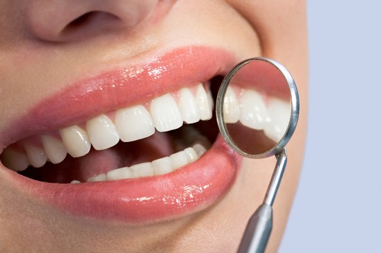 patient's white teeth